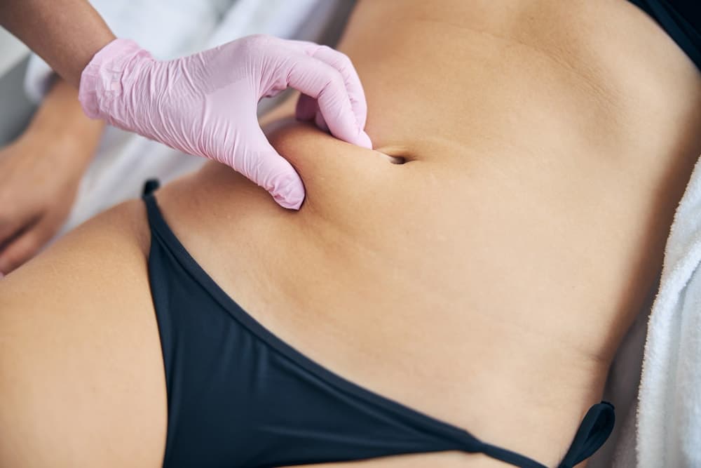 Cryolipolysis Andorra: treatment and prices